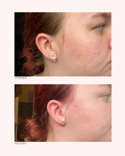 Beauty Rose - 2in1 peelende Maske