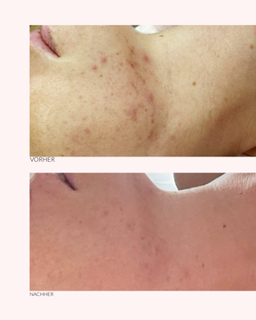 Beauty Rose - 2in1 peelende Maske