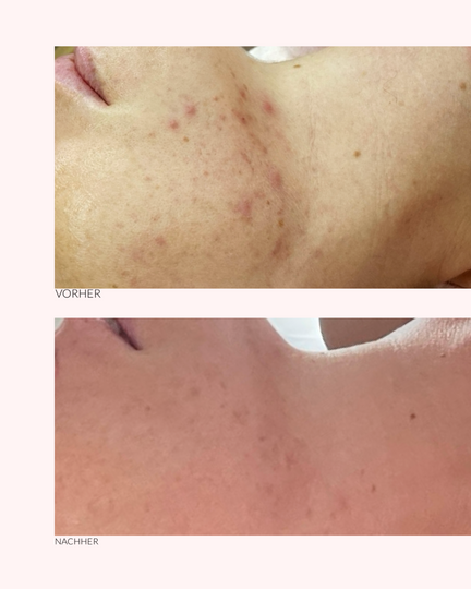 Beauty Rose - 2in1 peelende Maske